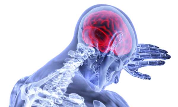Οι θάνατοι από εγκεφαλικό επεισόδιο μπορεί να διπλασιαστούν έως το 2050, προειδοποιούν οι επιστήμονες