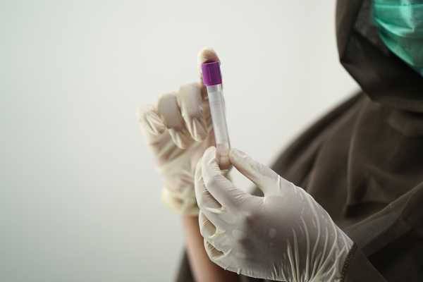 Νέα «υπερευαίσθητη» εξέταση αίματος ανιχνεύει βιοδείκτη πολλών καρκίνων
