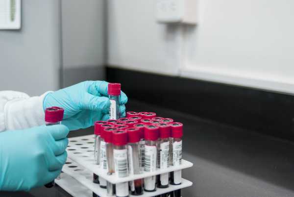 Ερευνητές αναπτύσσουν εξέταση αίματος που θα προβλέπει τον κίνδυνο εμφάνισης άνοιας μια δεκαετία πριν τη διάγνωση