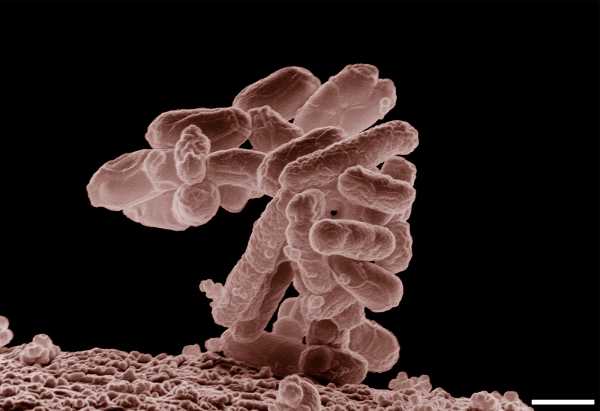 Το E. coli μπορεί μελλοντικά να αποκτήσει ανοσία στα κοινά αντιβιοτικά, προειδοποιεί νέα μελέτη