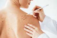 “Δερμάϊος”: Μήνας πρόληψης και ενημέρωσης για τον καρκίνο του δέρματος