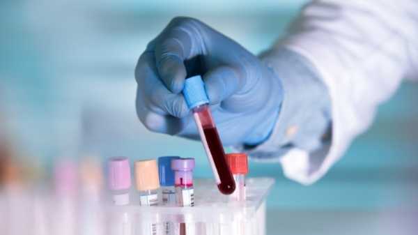 Βρετανία: Δόθηκε έγκριση στην πρώτη στον κόσμο γονιδιακή θεραπεία για αιματολογικές παθήσεις