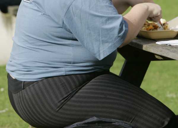 NHS: Ρεκόρ ασθενών με παχυσαρκία