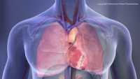 Πειραματικός βηματοδότης επαναφορτίζει την μπαταρία του χρησιμοποιώντας τους καρδιακούς παλμούς του ασθενούς